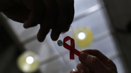Primeira mulher tem cura do HIV relatada após transplante de células-tronco